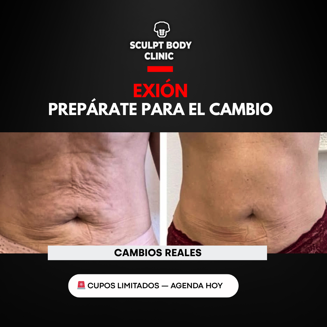 Caso 1
