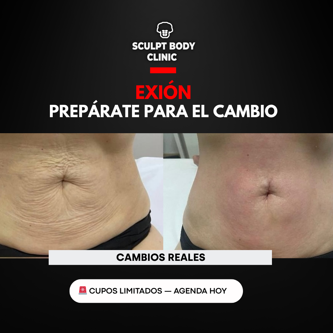 Caso 3